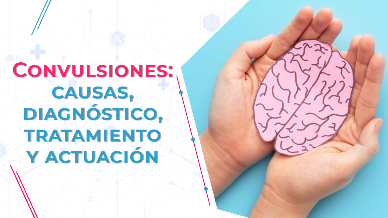 Imagen de Convulsiones: causas, diagnóstico, tratamiento y actuación
