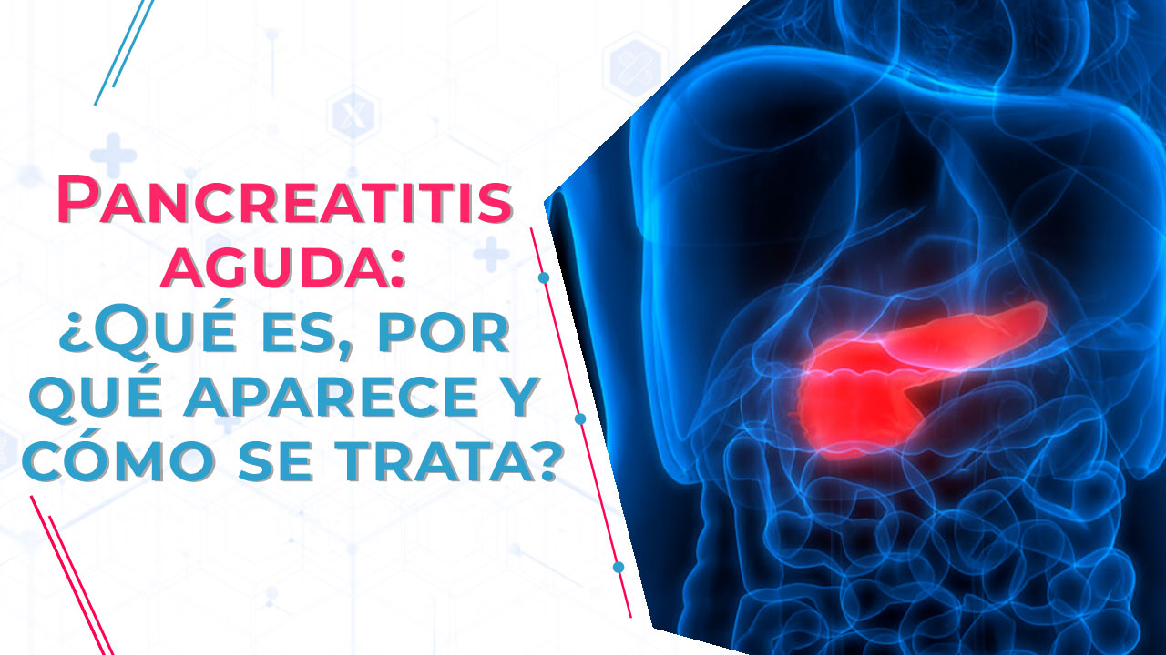 Imagen de Pancreatitis aguda: ¿Qué es, por qué aparece y cómo se trata?