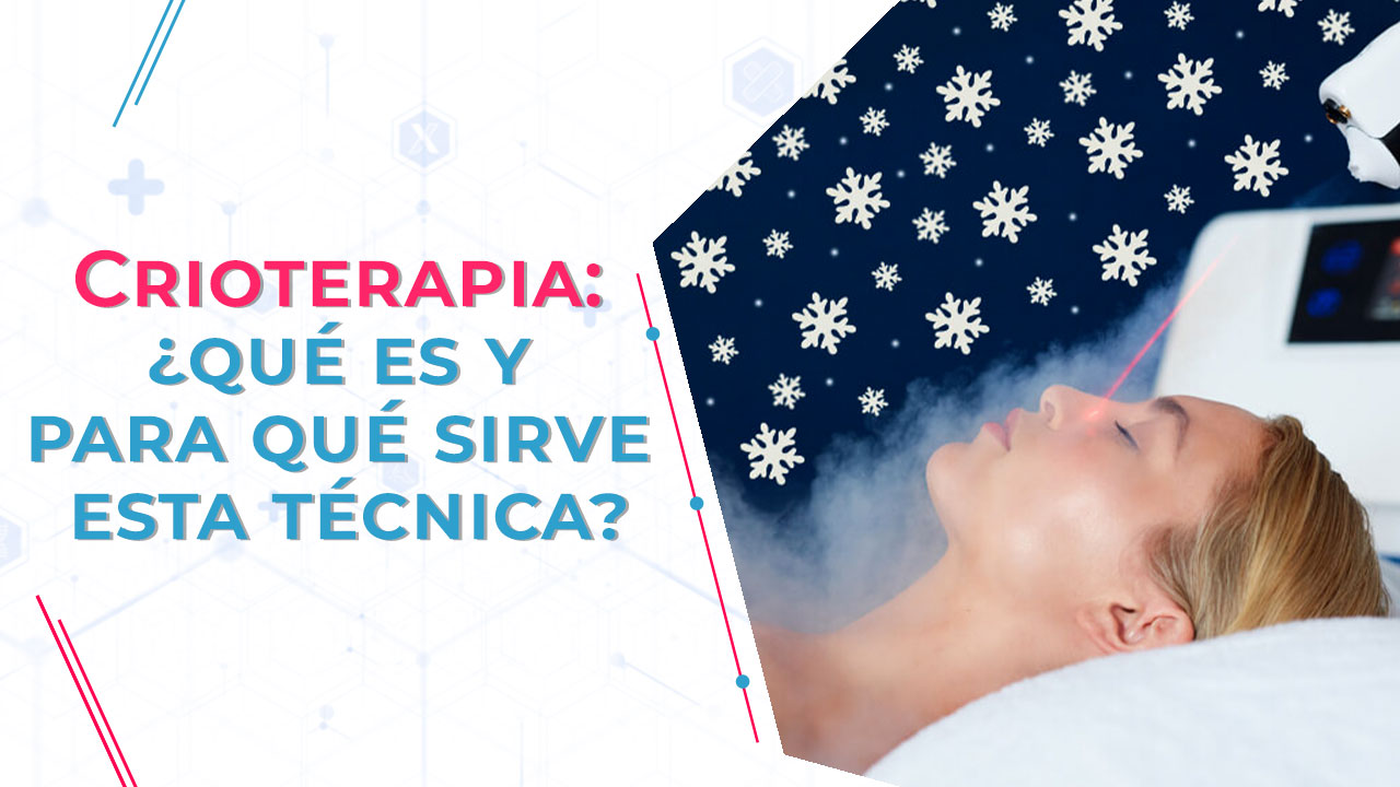 Imagen de Crioterapia: ¿qué es y para qué sirve esta técnica?