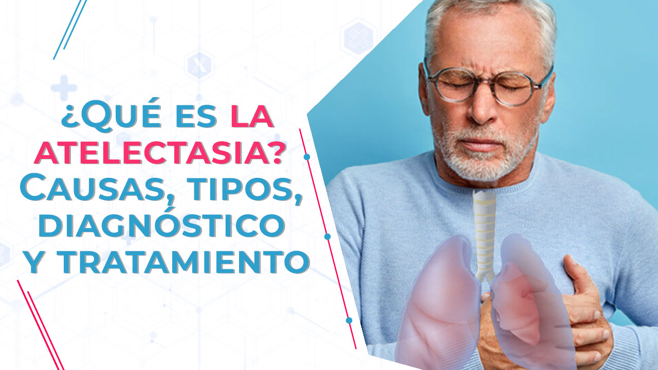 Imagen de ¿Qué es la atelectasia? Causas, tipos, diagnóstico y tratamiento