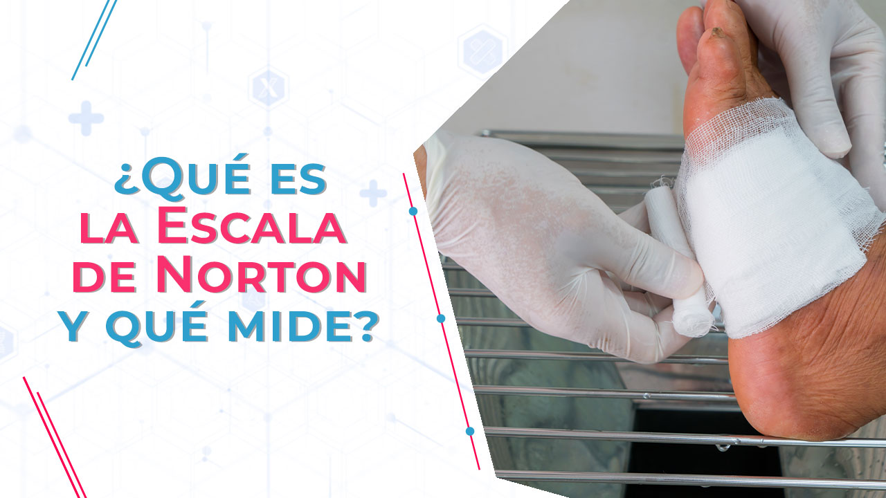 Imagen de ¿Qué es la Escala de Norton y qué mide?