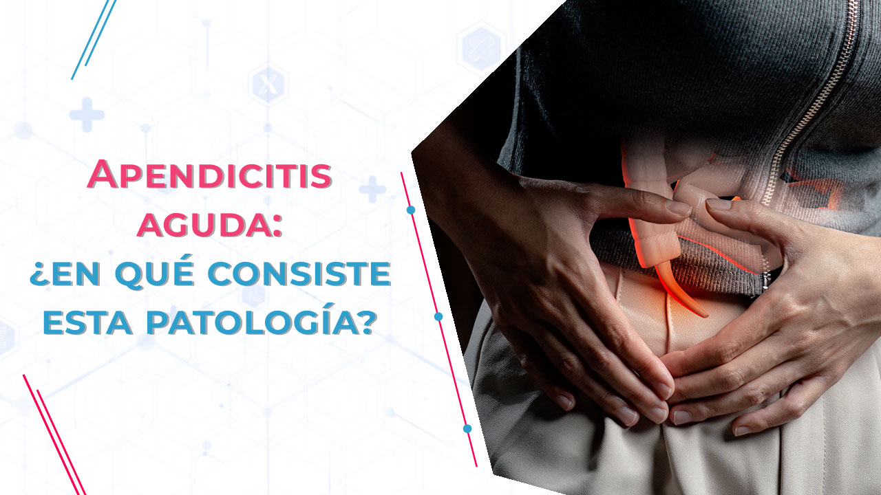 Imagen de Apendicitis aguda: ¿en qué consiste esta patología?