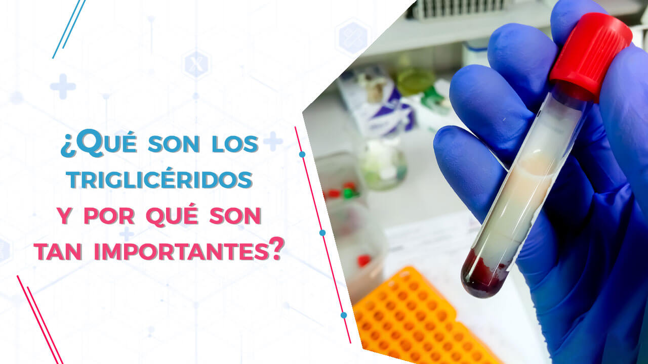 Imagen de ¿Qué son los triglicéridos y por qué son tan importantes?