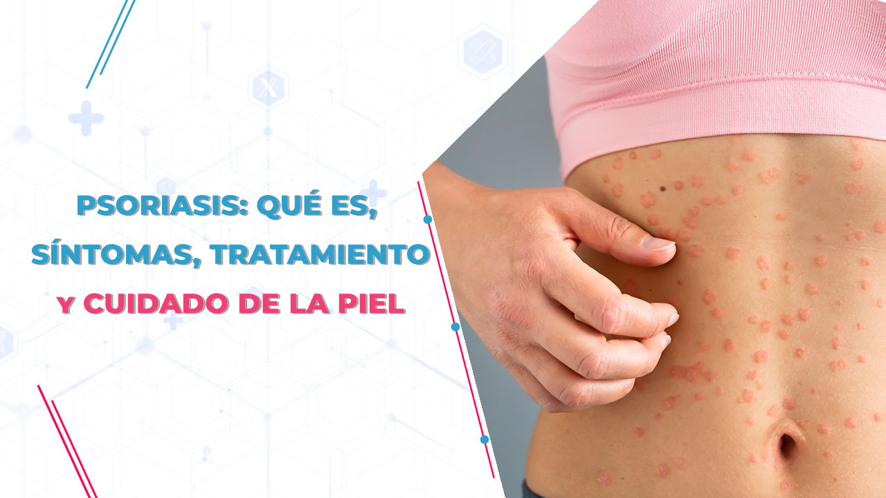 Psoriasis